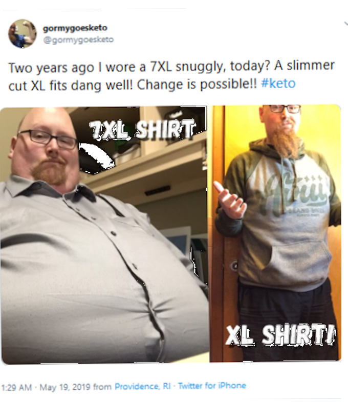 Extreme Weight Loss photo