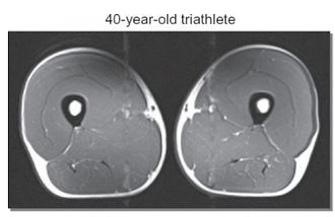 muscle-mass-40yrs-triathlete photo