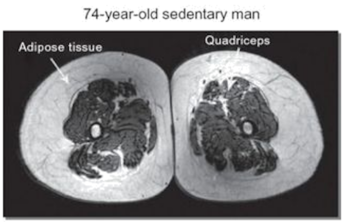 muscle-mass-74yrs-non-athletic photo